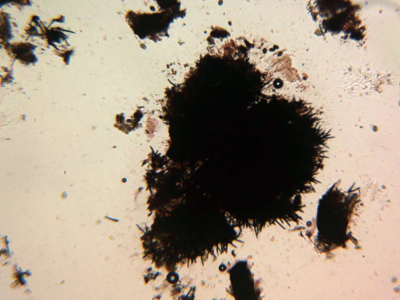 Coniochaeta ligniaria 10 - X 100